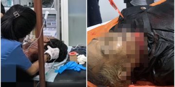 Dua Warga Sipil Kembali Jadi Korban Kekerasan di Yahukimo, Satu Meninggal Dunia