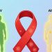 Kasus HIV AIDS di Kota Jayapura Capai 11.235