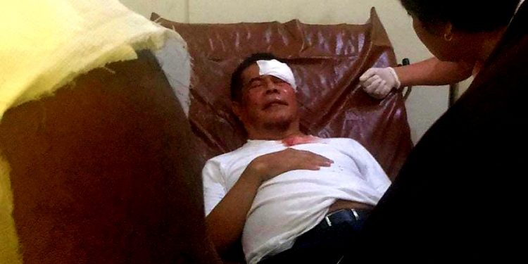 Pj Gubernur Papua Terkena Lemparan Batu