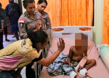Polisi Berikan Trauma Healing bagi Balita AL, Korban Kekerasan Fisik