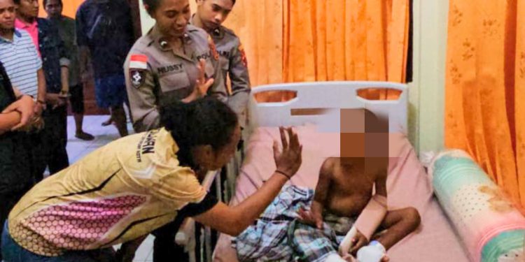 Polisi Berikan Trauma Healing bagi Balita AL, Korban Kekerasan Fisik