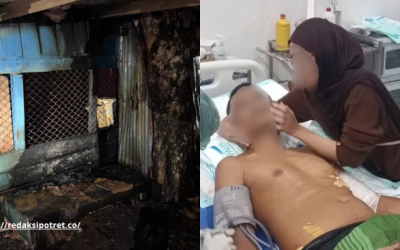 Korban mendapatkan perawatan medis. Tampak kios usai dibakar. (Foto : Istimewa)